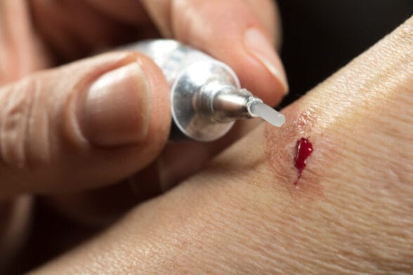 Thumbnail image of Ointment